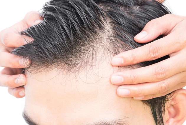 5 Simple Ways To Stop Hair Fall For Men Plixlife